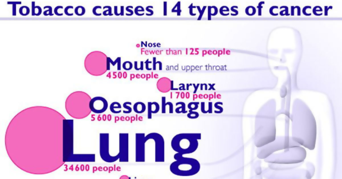 Cancers Caused By Smoking Infographic F