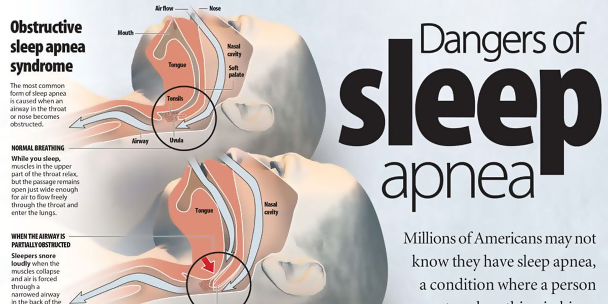 Dangers Of Sleep Apnea Infographic F