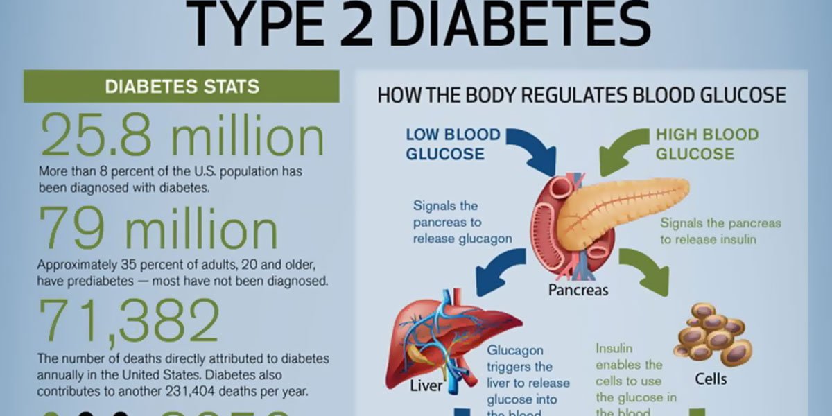 Decoding Type 2 Diabetes Infographic F