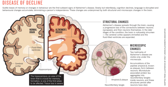 The Exercise Hormone Irisin Helps Protect Against Alzheimer’s