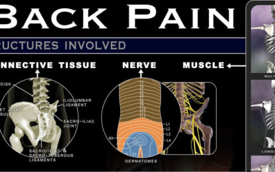 Lower Back Pain Infographic F