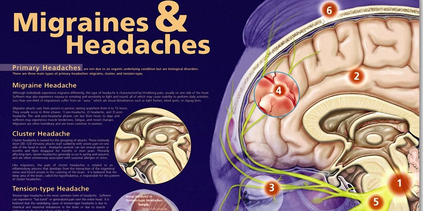 Migraines And Headaches Chart Cr