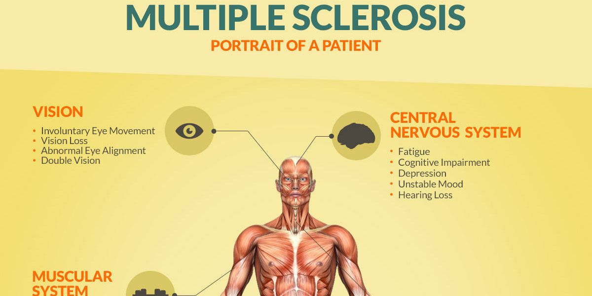 Multiple Sclerosis Infographic F
