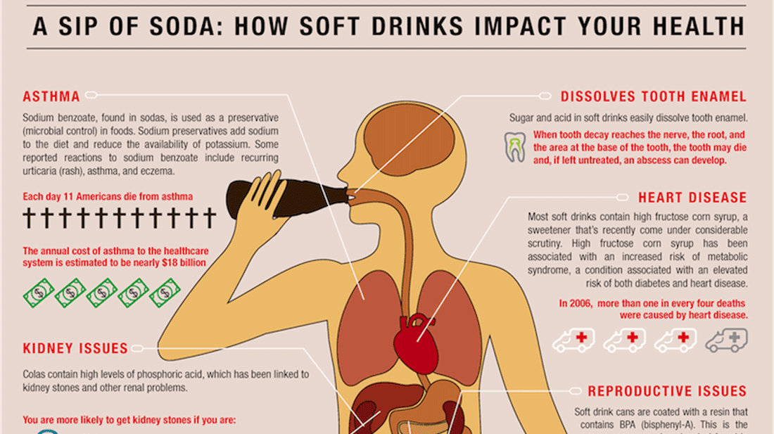 Soda Infographic