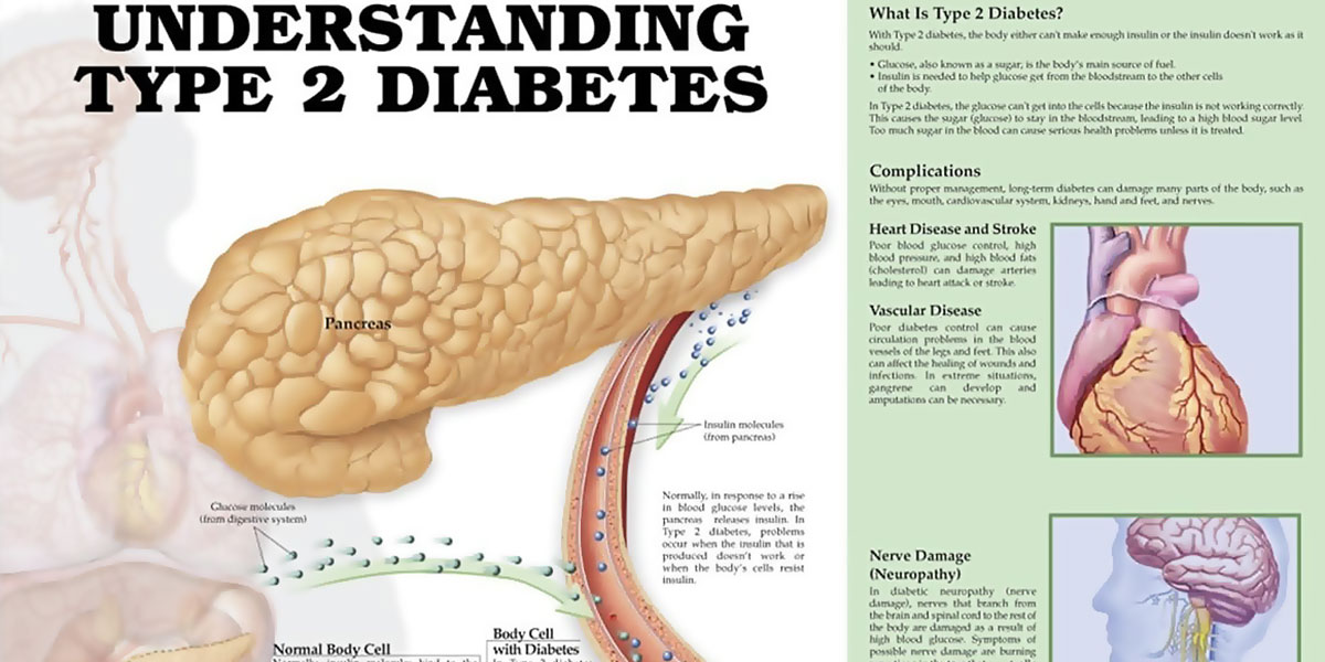 Inhaled Corticosteroids Associated With Increase in Diabetes