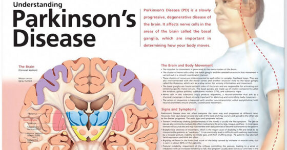 Understanding Parkinson’s Disease Chart