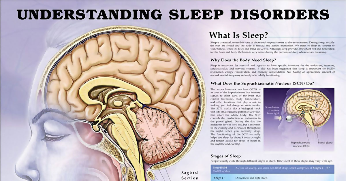 Understanding Sleep Disorders Chart F