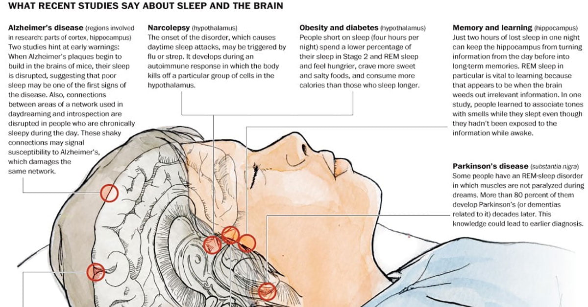 Disrupted Sleep Seems To Be Linked To Alzheimer’s Amyloid Plaques